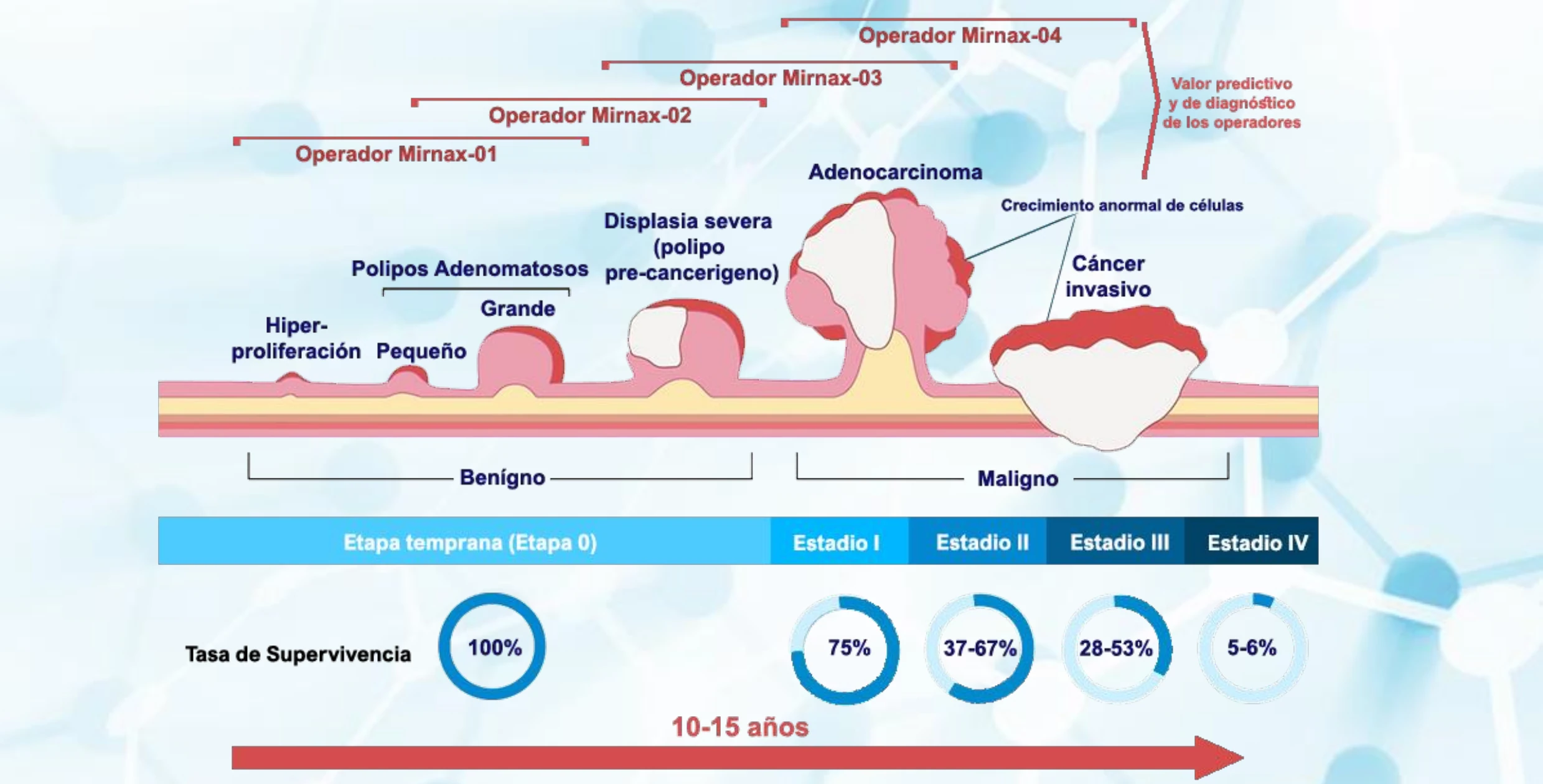 Detección cáncer de colon 5 Desarrollo cáncer de colon